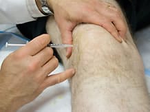 L'arthrose du genou - Laboratoire Dissolvurol